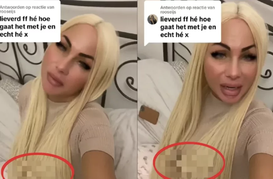 Gadverdamme: Volgers zien iets kleven in het haar van Samantha de Jong!