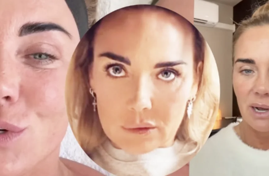 Monique Westenberg liegt staalhard over kromme lippen: &acute;Zitten wel degelijk fillers in!&acute;