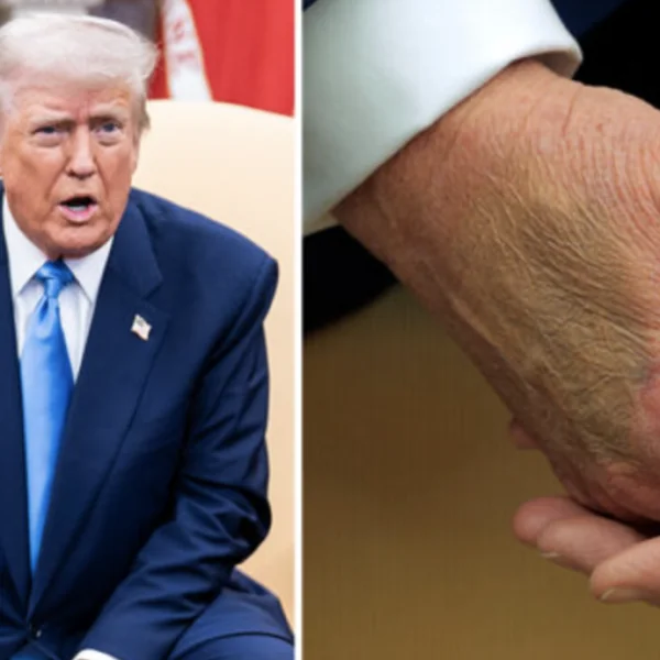 Witte Huis reageert na nare blauwe plek bij Donald Trump