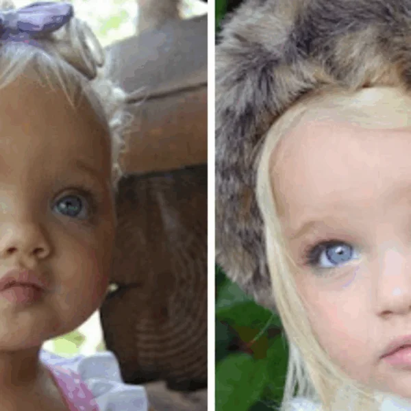 Toen ze slechts 2 jaar oud was, werd ze bestempeld als een levensechte pop &ndash; bekijk hoe ze er nu uitziet, vele jaren later