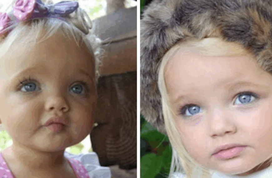 Toen ze slechts 2 jaar oud was, werd ze bestempeld als een levensechte pop &ndash; bekijk hoe ze er nu uitziet, vele jaren later