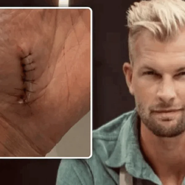 Ruben Van Gucht met spoed naar ziekenhuis tijdens opnames Celebrity Masterchef &ndash; &ldquo;Zat er een centimeter in&rdquo;