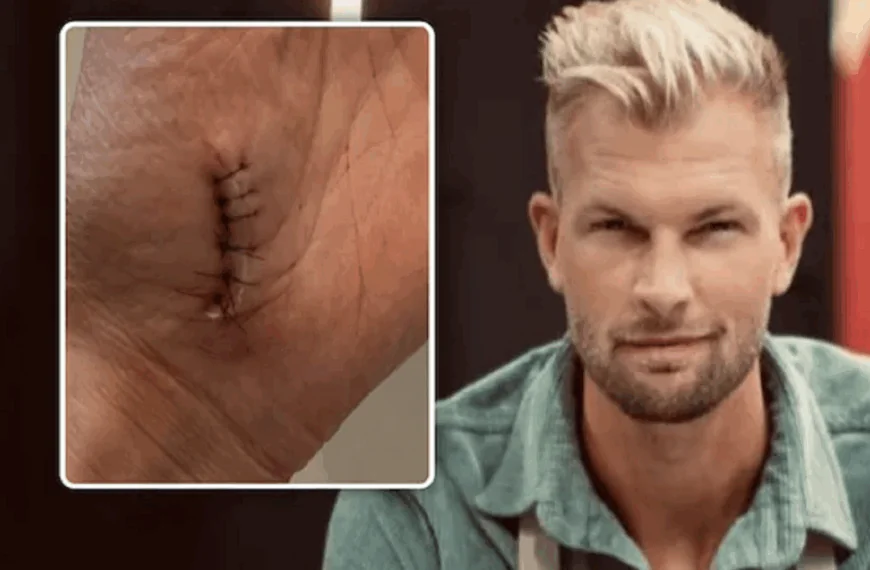 Ruben Van Gucht met spoed naar ziekenhuis tijdens opnames Celebrity Masterchef &ndash; &ldquo;Zat er een centimeter in&rdquo;