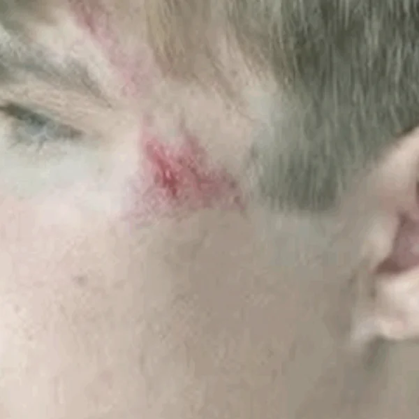 Tiener ziet iets wat niemand anders opmerkt in Scissortail park