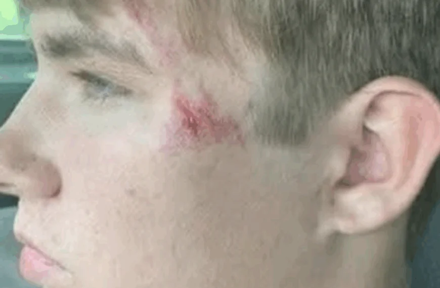 Tiener ziet iets wat niemand anders opmerkt in Scissortail park