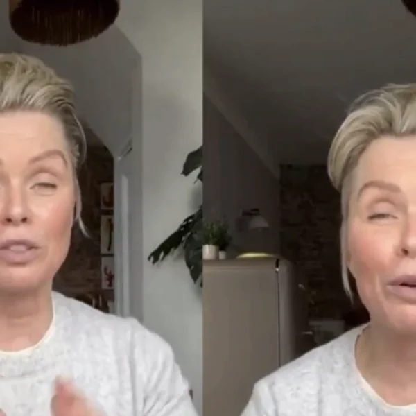 Bovenste helft van het gezicht van Bridget Maasland beweegt niet meer na botoxbehandeling