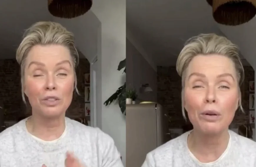 Bovenste helft van het gezicht van Bridget Maasland beweegt niet meer na botoxbehandeling